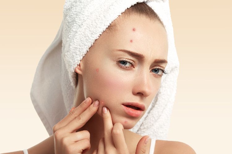 Inilah 5 Cara Cepat Hilangkan Bopeng di Wajah!